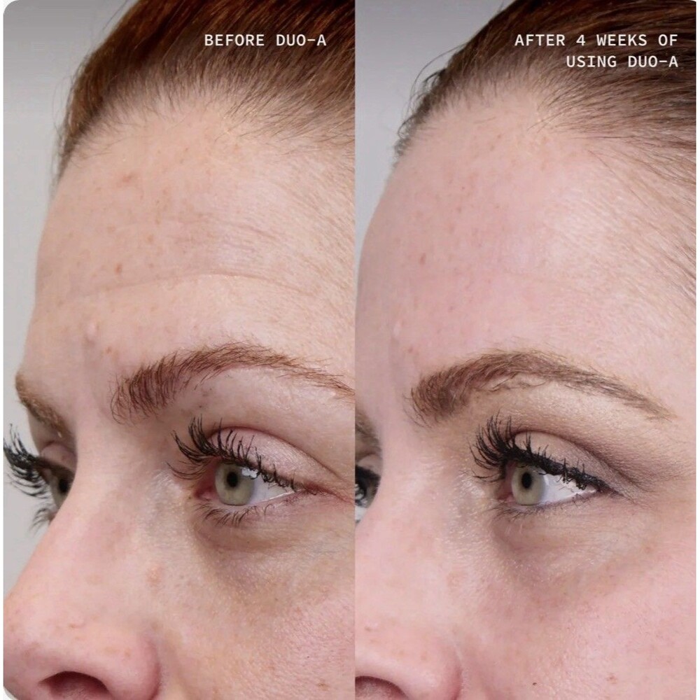 Cosmedix Duo-A Nightly 1% Retinoid Treatment 30ml / 1oz Dual Retinol & Retinal - Picture 3 of 6